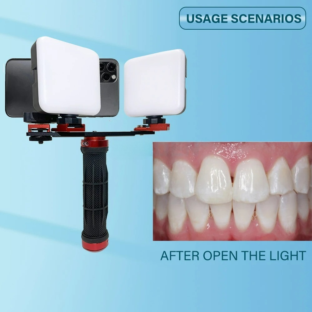 Dental Photography Light Phone - đánh giá và giá Phone Accessories For Photography
